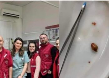 Fantastike: Ekipi i Emergjencës në Vushtrri shpëtojnë një fëmijë 4 vjeçar, i kishte mbetur kikiriku në fyt