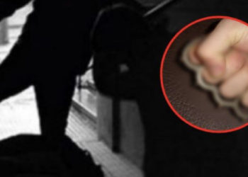 Dy persona bëjnë llom 31-vjeçarin në Vushtrri, ia thyejnë hundën duke e goditur me boks të hekurit