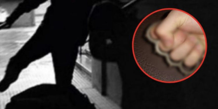 Dy persona bëjnë llom 31-vjeçarin në Vushtrri, ia thyejnë hundën duke e goditur me boks të hekurit