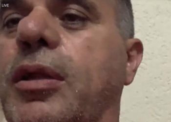 “5 veta të maskuar na sulmuan”, rrëfen mitrovicasi që u sulmua në veri