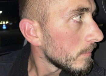 Qytetari pretendon se është sulmuar fizikisht nga një polic në stacionin policor në Mitrovicë të Jugut