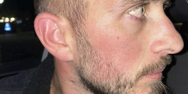 Qytetari pretendon se është sulmuar fizikisht nga një polic në stacionin policor në Mitrovicë të Jugut