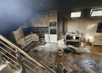 Vajza 13-vjeçe që u lëndua nga shpërthimi në Kçiq merr trajtim falas në Turqi me ndërmejtësimin e Qeverisë